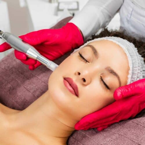 Woman getting microneedling | Skin N Tox Aesthetics | Meridian, ID