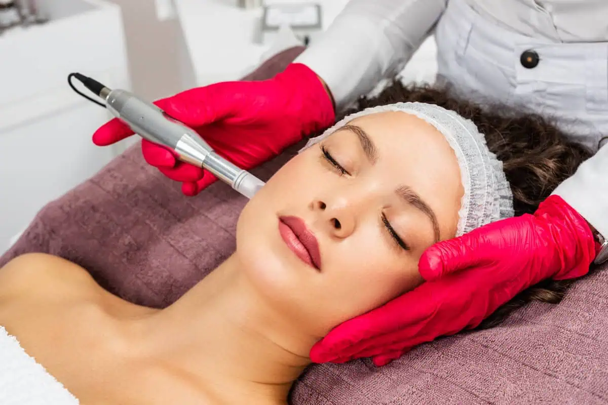 Microneedling: How Does It Really Work