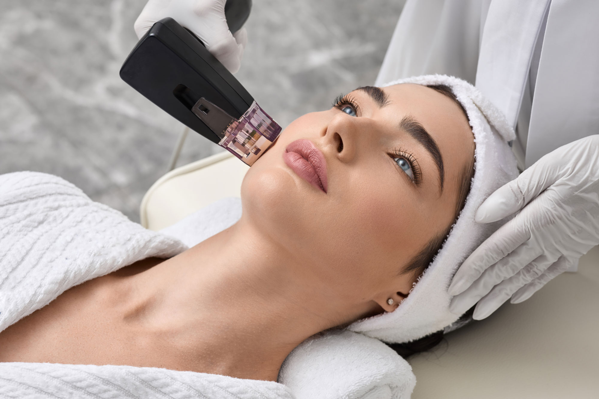 Patient looking calm during a Morpheus8 session to experience full RF microneedling benefits.